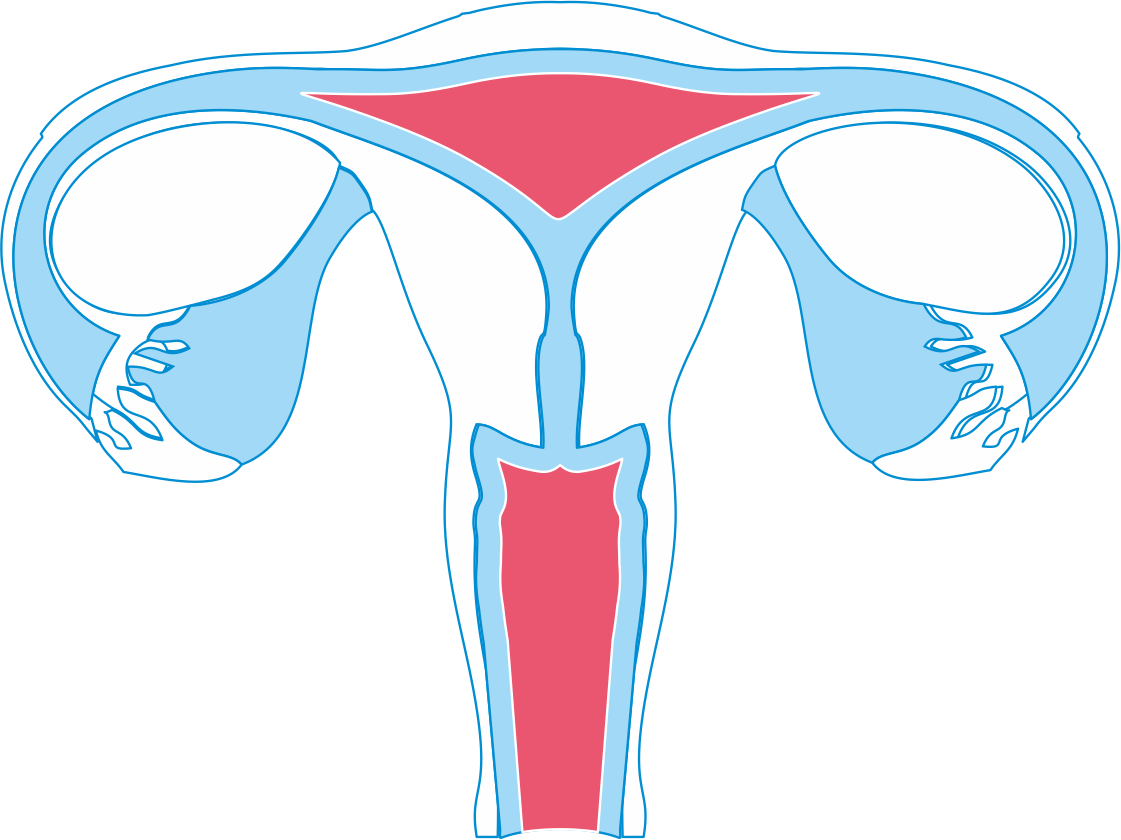 Niski progesteron, stężenie progesteronu, endometrium